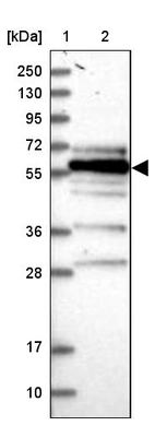Lane 1: Marker [kDa] 250, 130, 95, 72, 55, 36, 28, 17, 10_br/_Lane 2: Human cell line RT-4