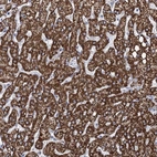 Anti-THUMPD3 Antibody