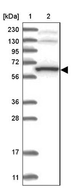 Anti-THUMPD3 Antibody