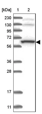 Lane 1: Marker [kDa] 230, 130, 95, 72, 56, 36, 28, 17, 11_br/_Lane 2: Human cell line RT-4
