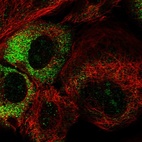 Immunofluorescent staining of human cell line A-431 shows localization to nucleoli & cytosol.