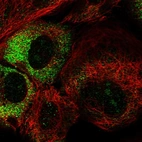 Immunofluorescent staining of human cell line A-431 shows localization to nucleoli & cytosol.