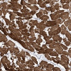 Anti-ZNF654 Antibody