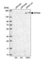 Western blot analysis in U2OS cells transfected with control siRNA, target specific siRNA probe #1 and #2, using Anti-ZNF654 antibody. Remaining relative intensity is presented.