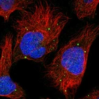 Immunofluorescent staining of human cell line U-2 OS shows localization to vesicles.