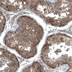 Immunohistochemical staining of human testis shows moderate cytoplasmic positivity in cells in seminiferous ducts.