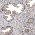 Immunohistochemical staining of human prostate shows weak to moderate cytoplasmic positivity in glandular cells.
