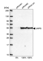Western blot analysis in U2OS cells transfected with control siRNA, target specific siRNA probe #1 and #2, using Anti-UMPS antibody. Remaining relative intensity is presented.