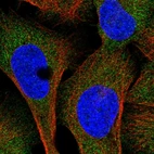 Immunofluorescent staining of human cell line U-2 OS shows localization to cytosol.
