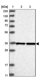 Lane 1: Marker [kDa] 230, 130, 95, 72, 56, 36, 28, 17, 11_br/_Lane 2: Human cell line RT-4_br/_Lane 3: Human cell line U-251MG sp