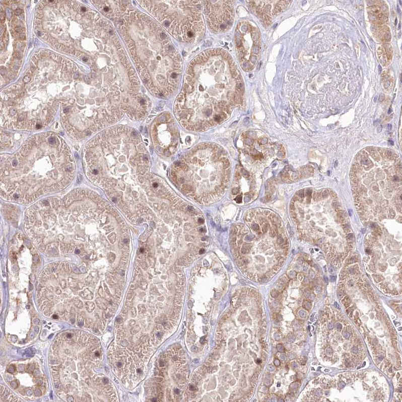Anti-HELT Antibody