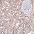 Anti-HELT Antibody