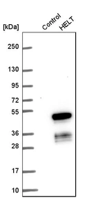 Western blot analysis in control (vector only transfected HEK293T lysate) and HELT over-expression lysate (Co-expressed with a C-terminal myc-DDK tag (~3.1 kDa) in mammalian HEK293T cells, LY422265).