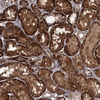 Anti-RPP14 Antibody