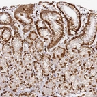Anti-C6orf141 Antibody