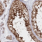 Anti-KATNA1 Antibody