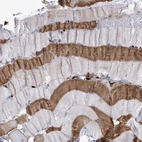 Anti-ANKRD23 Antibody