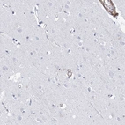 Immunohistochemical staining of human cerebral cortex shows no positivity in neurons as expected.