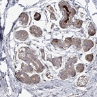 Immunohistochemical staining of human breast shows no cytoplasmic positivity in myoepithelial cells.