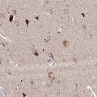 Immunohistochemical staining of human cerebral cortex shows moderate to strong granular cytoplasmic positivity in neurons.