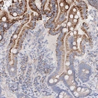 Immunohistochemical staining of human duodenum shows moderate granular cytoplasmic positivity in glandular cells.