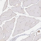 Immunohistochemical staining of human skeletal muscle shows no positivity in myocytes as expected.