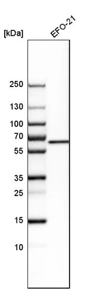 Western blot analysis in human cell line EFO-21.