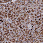 Anti-SLC7A7 Antibody