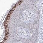Immunohistochemical staining of human skin shows strong cytoplasmic positivity in squamous epithelial cells.