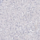 Immunohistochemical staining of human liver shows no positivity in hepatocytes as expected.