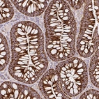 Immunohistochemical staining of human colon shows strong granular positivity in cytoplasm in glandular cells.