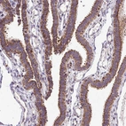 Immunohistochemical staining of human Fallopian tube shows moderate granular positivity in cytoplasm in glandular cells.