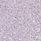 Anti-ELOVL3 Antibody