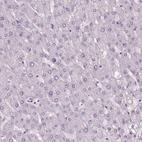 Immunohistochemical staining of human liver shows no positivity in hepatocytes as expected.