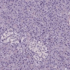 Immunohistochemical staining of human pancreas shows no positivity in exocrine glandular cells as expected.