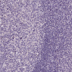 Immunohistochemical staining of human tonsil shows no positivity in non-germinal center cells as expected.