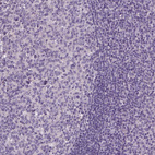 Anti-ELOVL3 Antibody