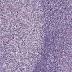 Immunohistochemical staining of human tonsil shows no positivity in non-germinal center cells as expected.