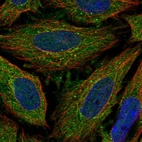 Immunofluorescent staining of human cell line SiHa shows localization to cytosol & vesicles.
