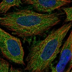 Immunofluorescent staining of human cell line SiHa shows localization to cytosol & vesicles.