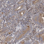 Anti-ATP11B Antibody