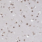 Anti-ATP11B Antibody