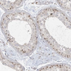 Anti-NAF1 Antibody