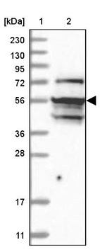 Lane 1: Marker [kDa] 230, 130, 95, 72, 56, 36, 28, 17, 11_br/_Lane 2: Human cell line RT-4