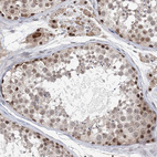 Immunohistochemical staining of human Testis shows moderate nuclear positivity in cells in seminiferous ducts and Leydig cells.