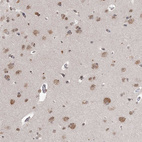 Immunohistochemical staining of human Cerebral cortex shows moderate nuclear and cytoplasmic positivity in neuronal and glial cells.