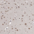 Immunohistochemical staining of human Cerebral cortex shows moderate nuclear and cytoplasmic positivity in neuronal and glial cells.