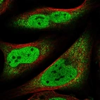 Immunofluorescent staining of human cell line U-2 OS shows localization to nucleoplasm & cytosol.