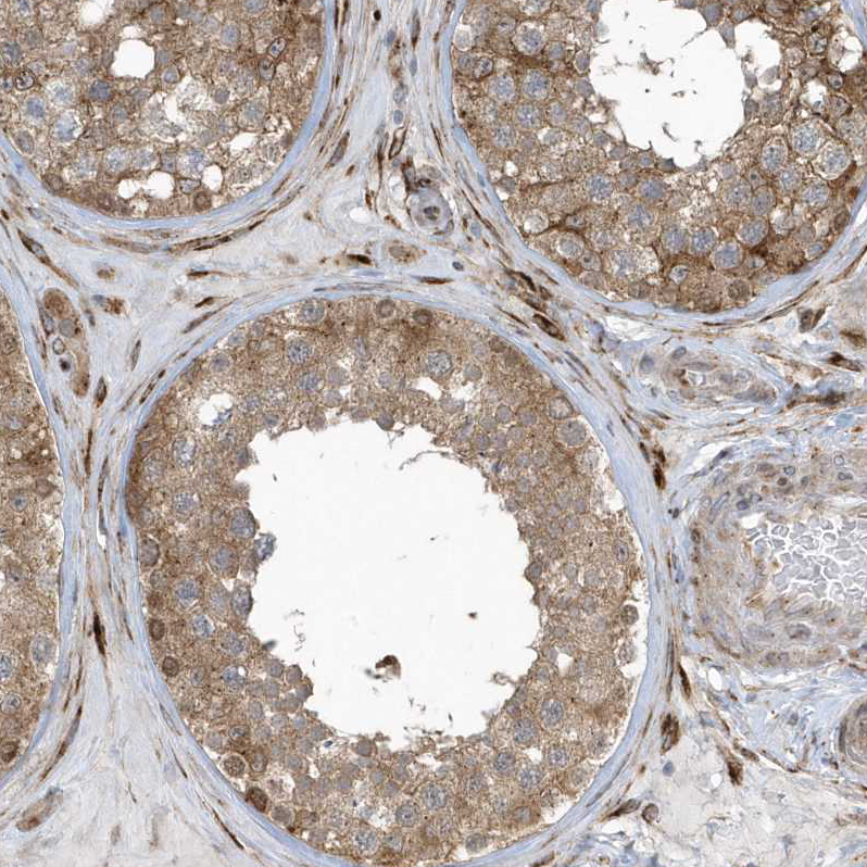 Anti-FAM98A Antibody