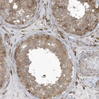 Anti-FAM98A Antibody